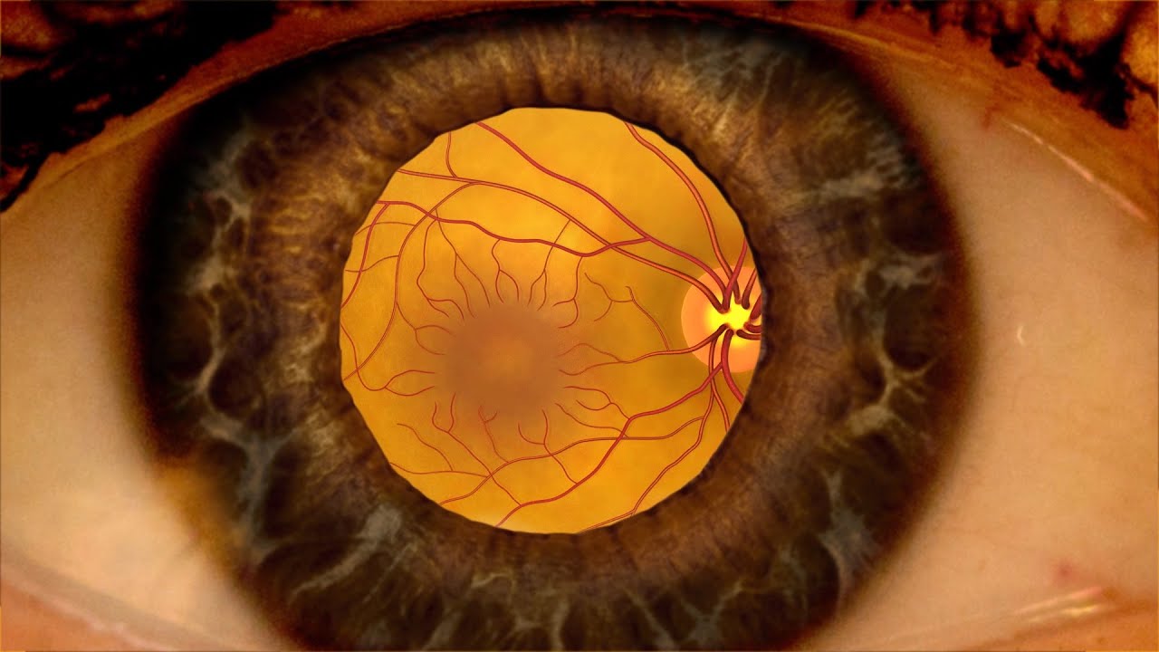 Close-up of a human eye showing the iris and retinal blood vessels in warm amber and brown tones